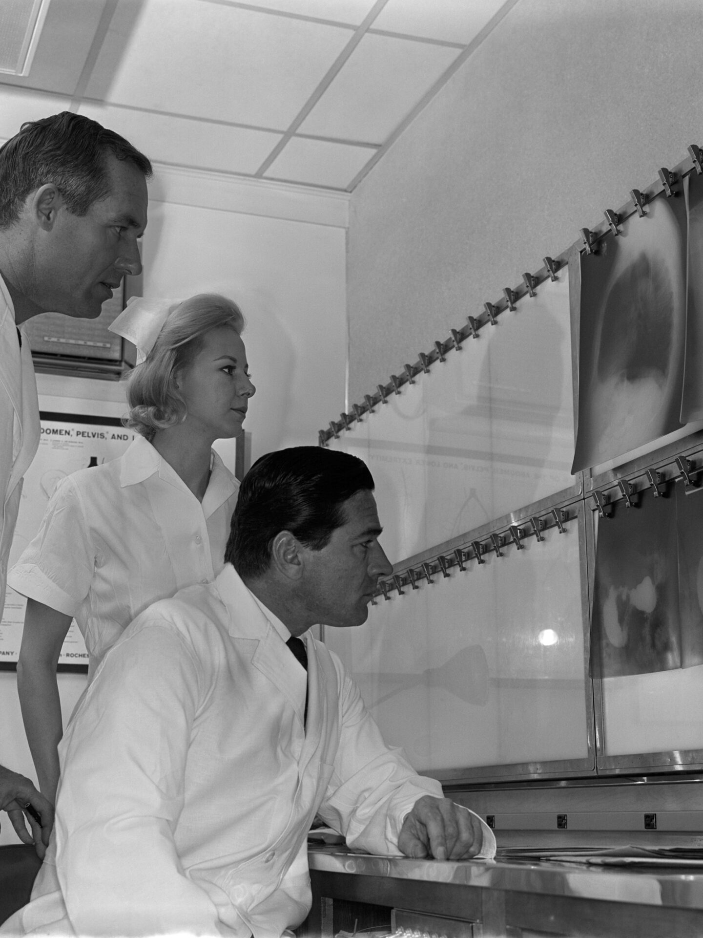 Tre dottori osservano le radiografie polmonari di un paziente.